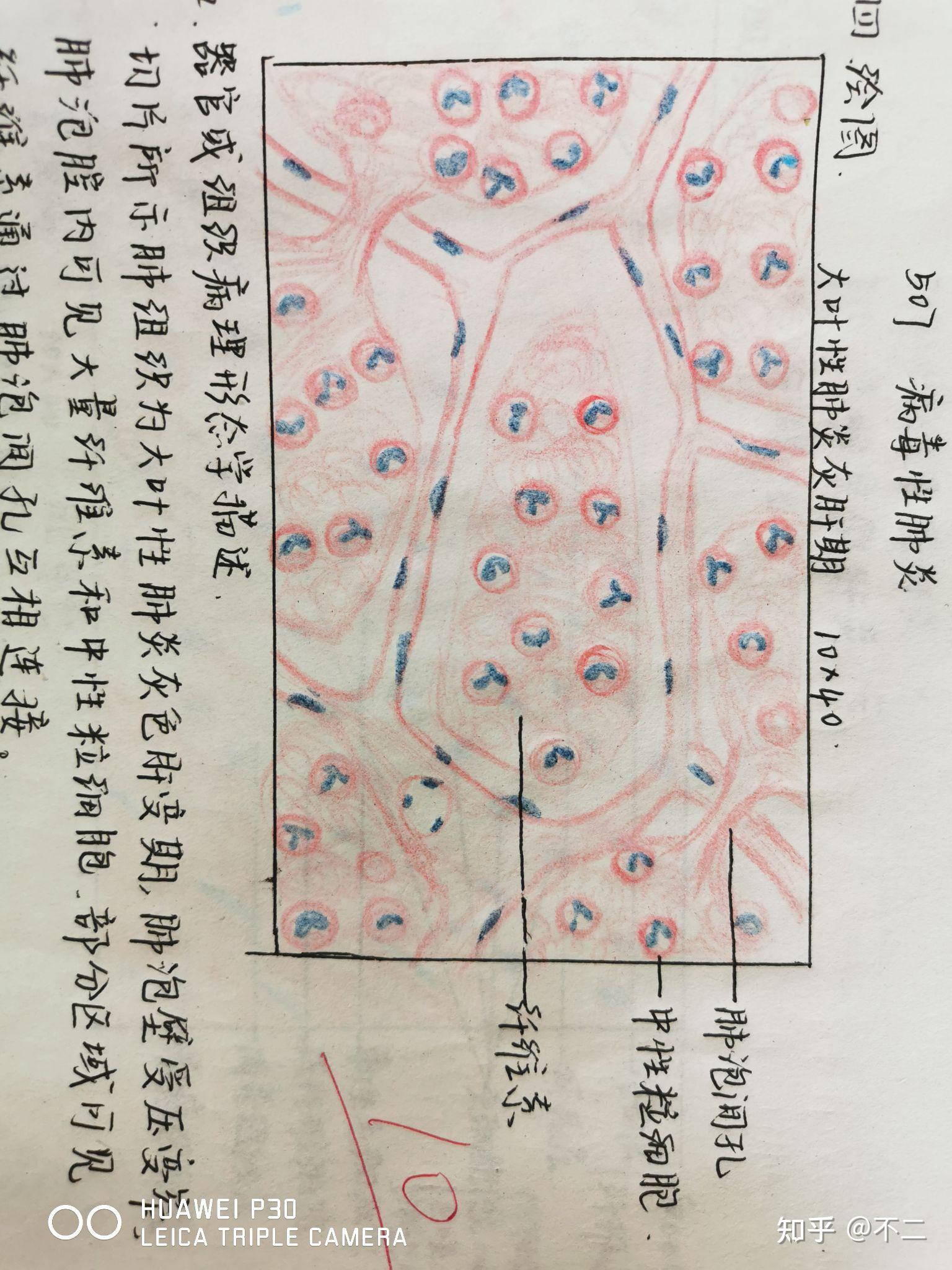 炎症细胞红蓝铅笔绘图图片