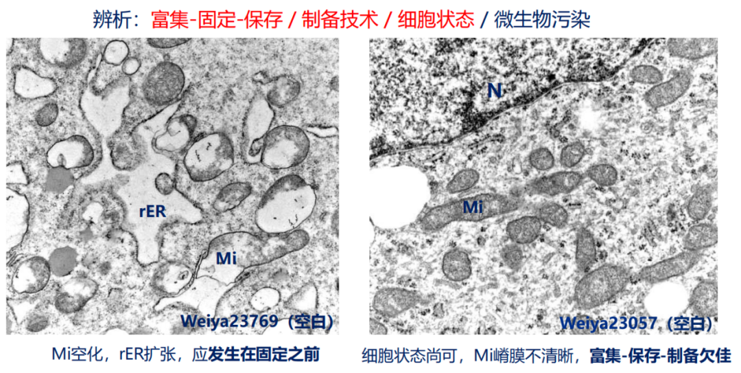 微亚实验室 | 李伯勤:医学电镜观察问题简析 I——培养细胞TEM观察 - 知乎