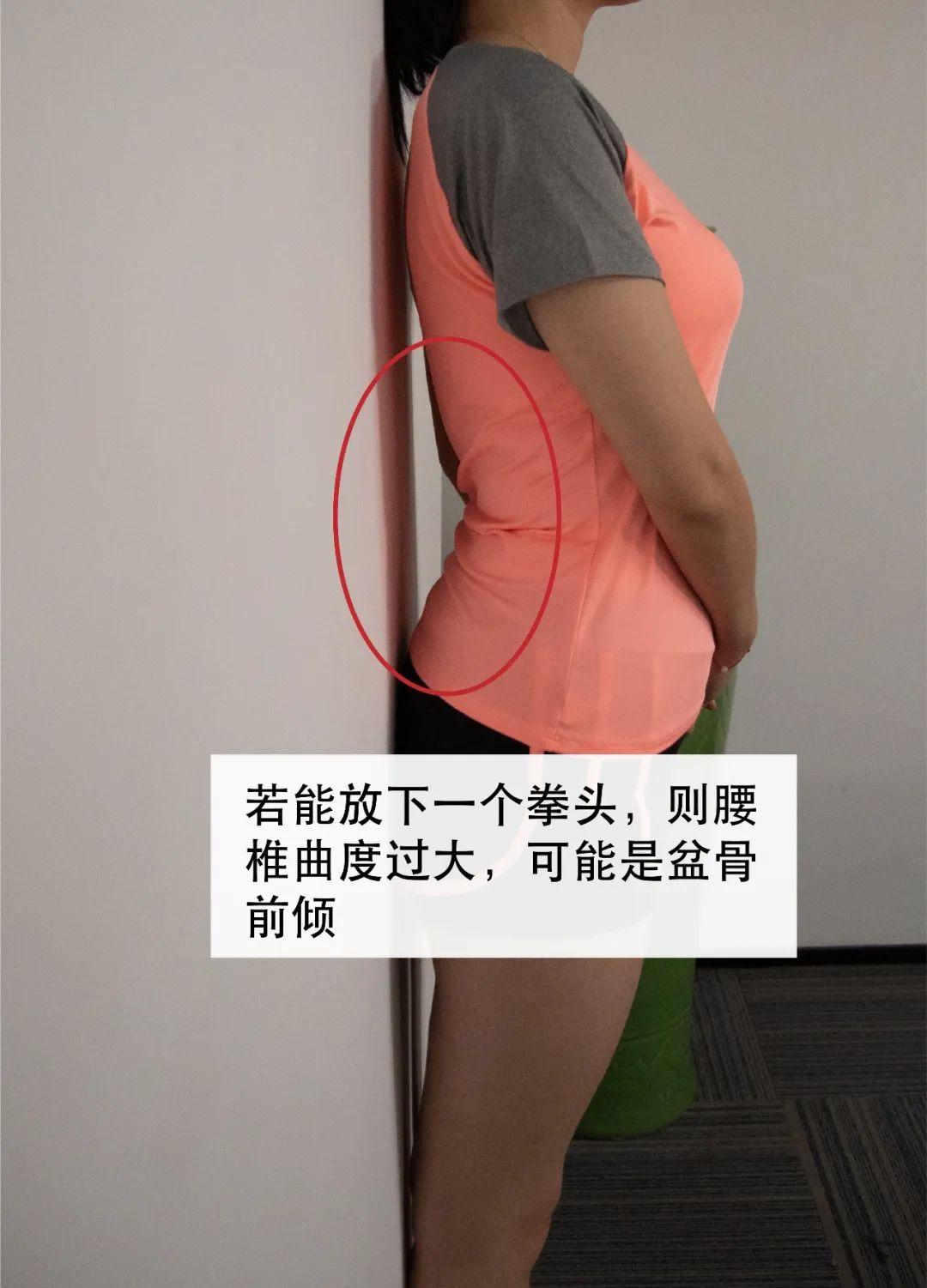 怎么样测试自己是否盆骨前倾? - 知乎