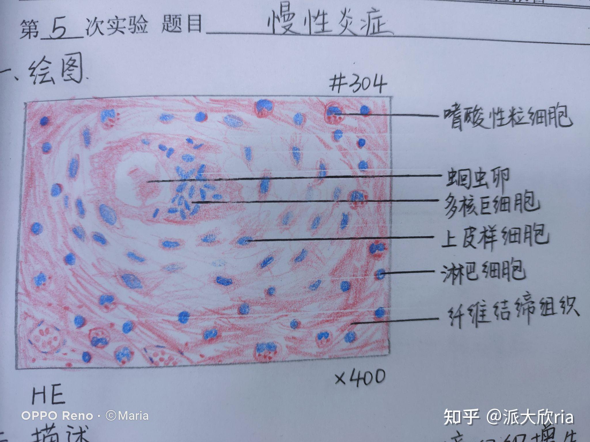 病理學實驗報告紅藍鉛筆手繪圖有老師批改