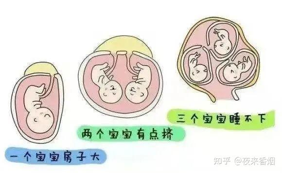 怀了多胎宝宝,一定要注意这些问题! - 知乎