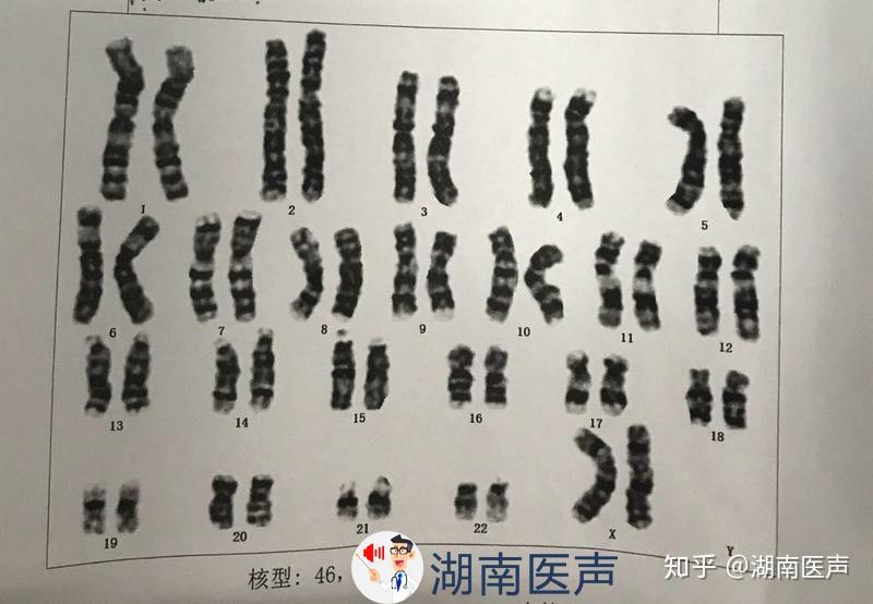 养了五年的男孩变女孩基因里藏着你不知道的密码