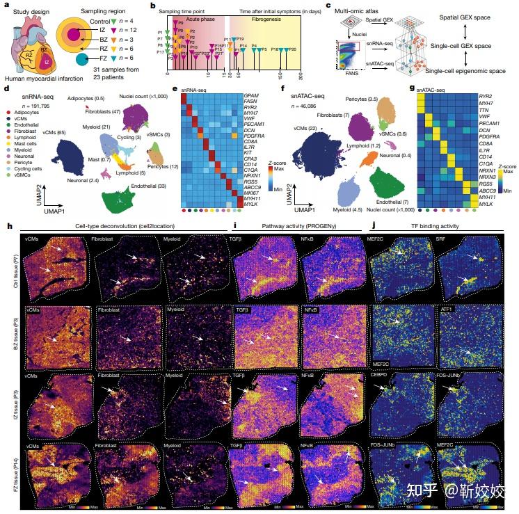 Nature | 你知道吗，心梗后竟会发生这些变化！多组学分析为你揭晓心肌梗死的时空图谱 - 知乎