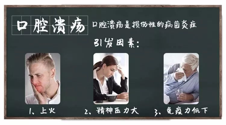 这个太有用,以备不时之需:口腔溃疡疼死人!用它溃疡、上火、发炎都拜拜! - 知乎