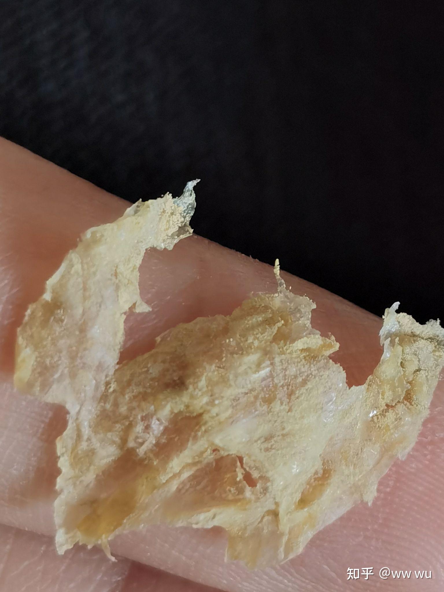为什么我掏出来的耳屎是桶状的就是一层薄膜粘附在耳壁上
