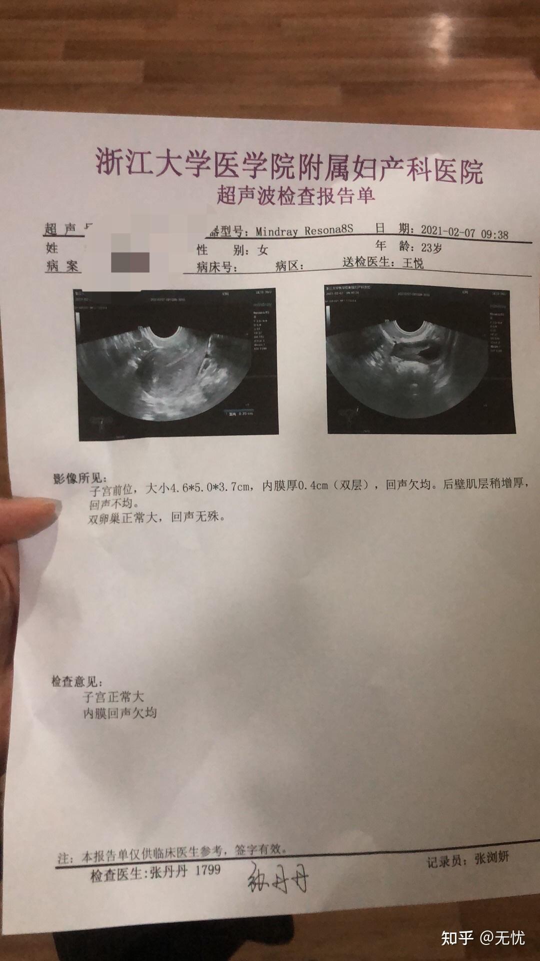 一次無痛人流77一次藥流全過程