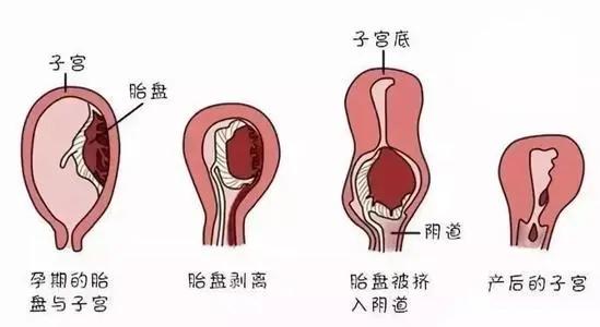 月经来潮前宫颈变化图图片