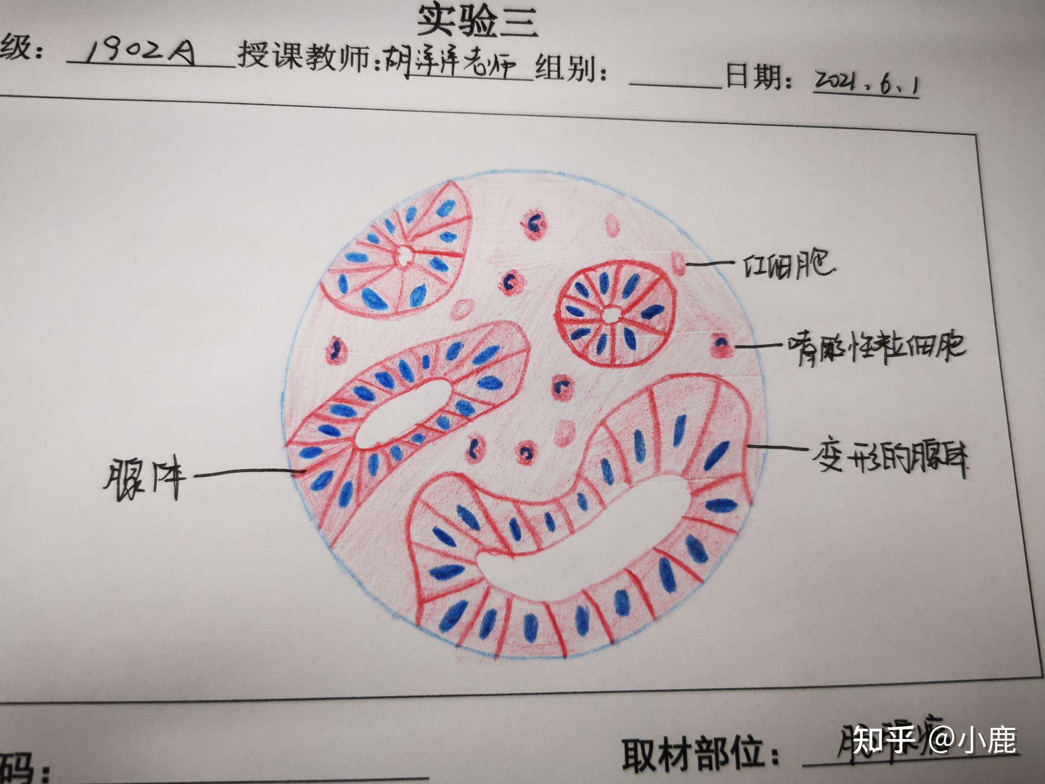 部分病理学切片红蓝铅笔手绘图,画的有一点点丑