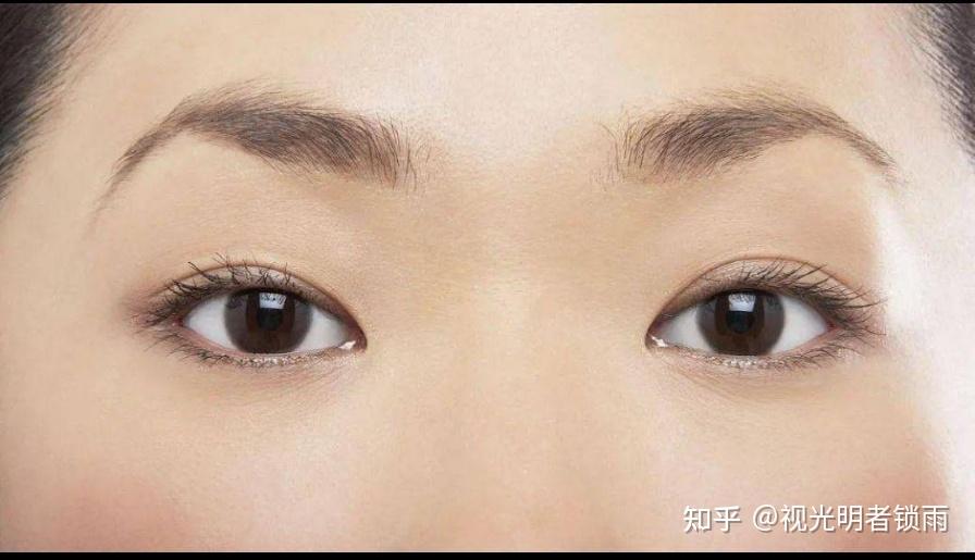双眼视觉 - 知乎