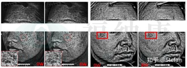 详解富勒烯护肤功效第二弹美白淡斑