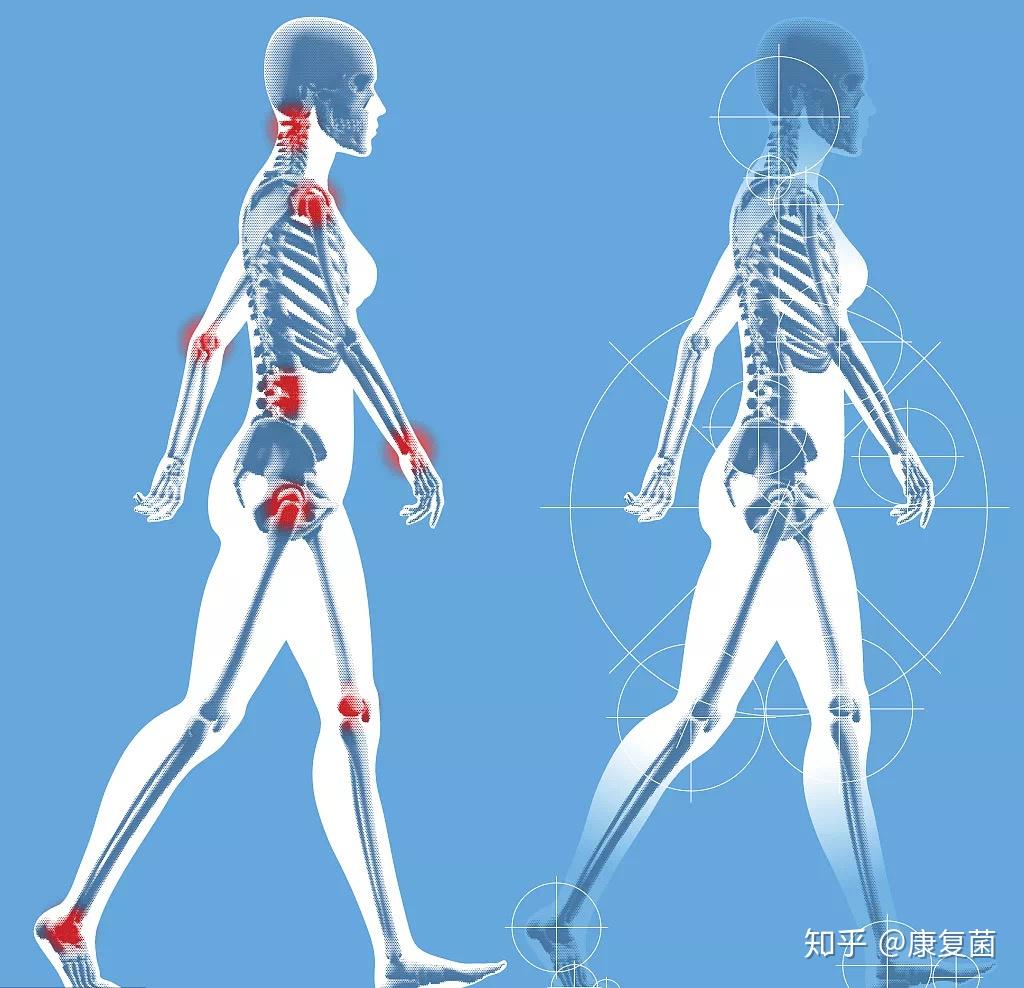 骨盆=步行 - 知乎