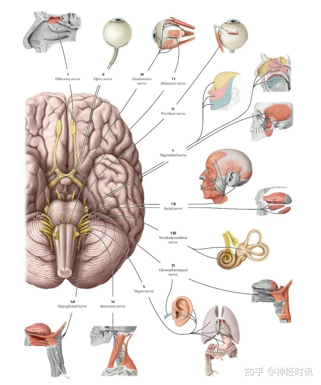 脑干出血穿刺置管引流 - 脑医汇 - 神外资讯 - 神介资讯
