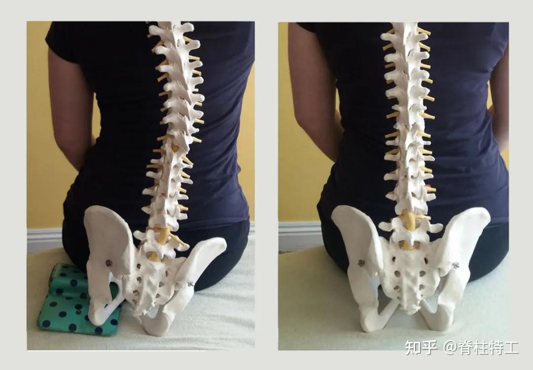 骨盆最害怕6件事中3个以上就要小心