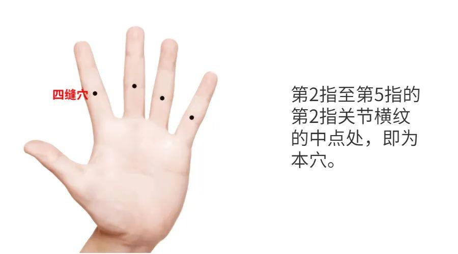 2滋肾首先,对于局部手指肿胀,关节疼痛的问题,局部患处的艾灸肯定是少