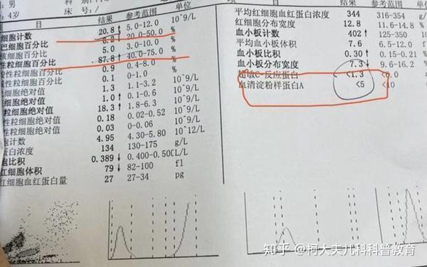 小儿呕吐病因很多种 但是这个病因常见 需要紧急处理 家长须知 知乎