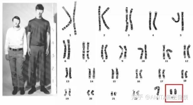 “XXY” or “XYY”:带你走进真实的“第三性别”群体 - 知乎