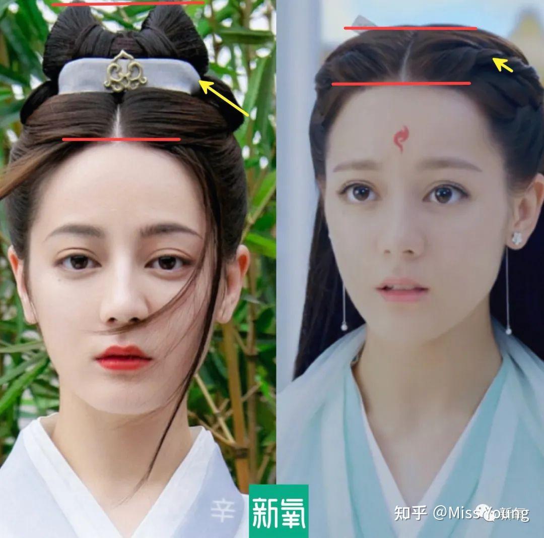 颅顶低真的很丑吗