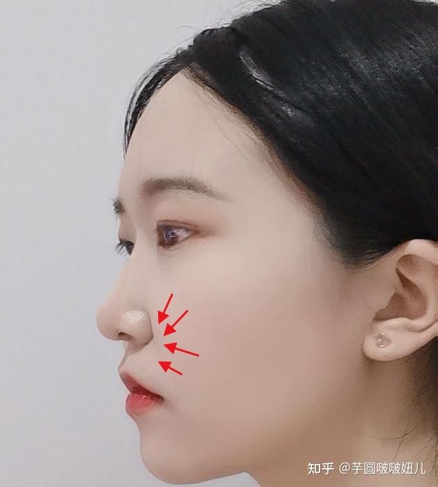 我这个侧脸哪里有问题?总觉得中间凹下去,怎么改善?