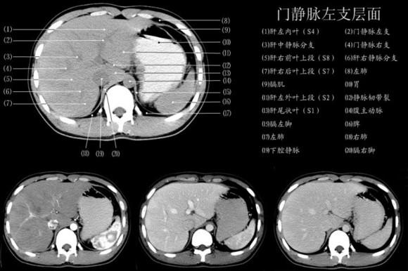 一图教你读懂 腹部CT - 知乎