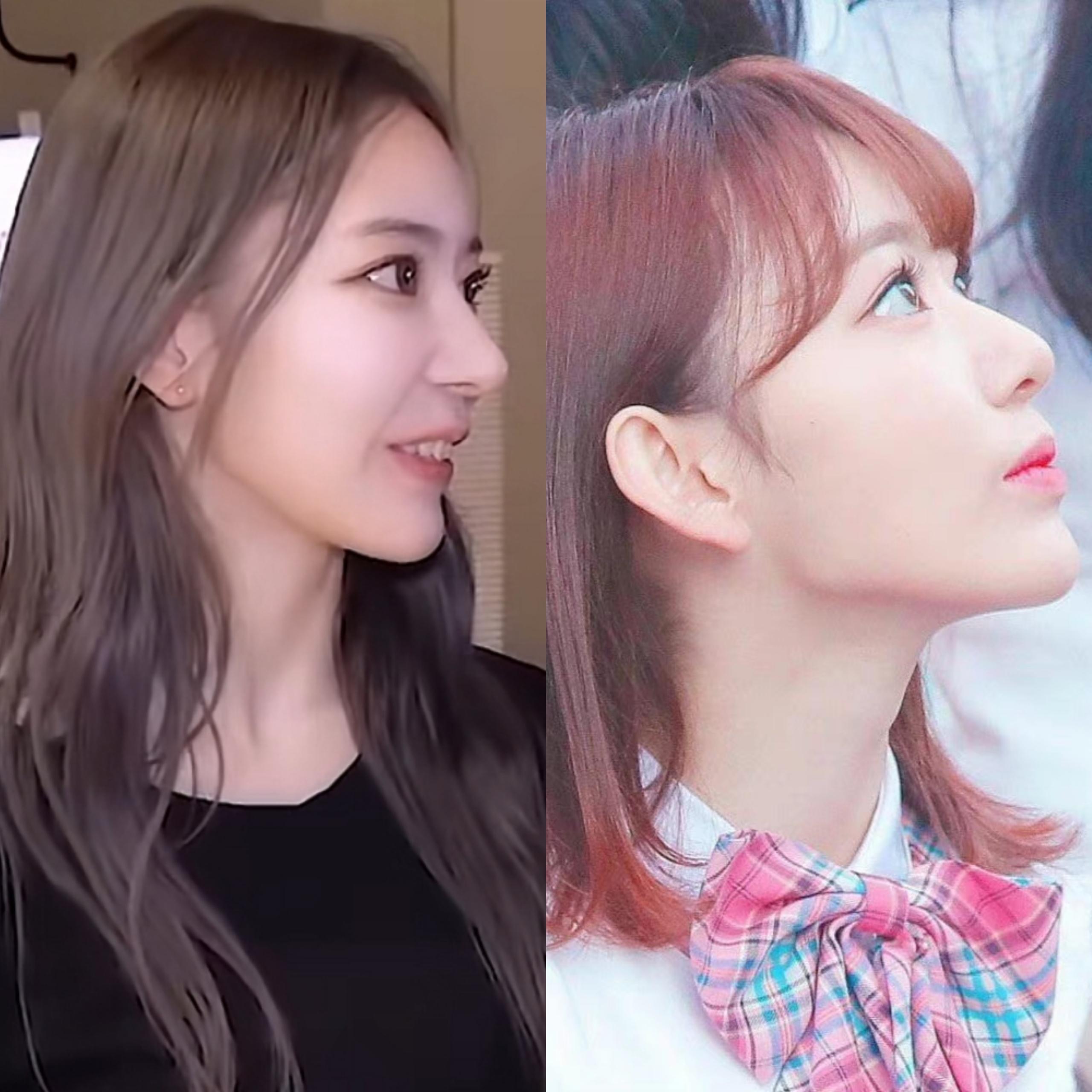 大家都是为了变美才去整容,但有多少女明星整完还不如不整.