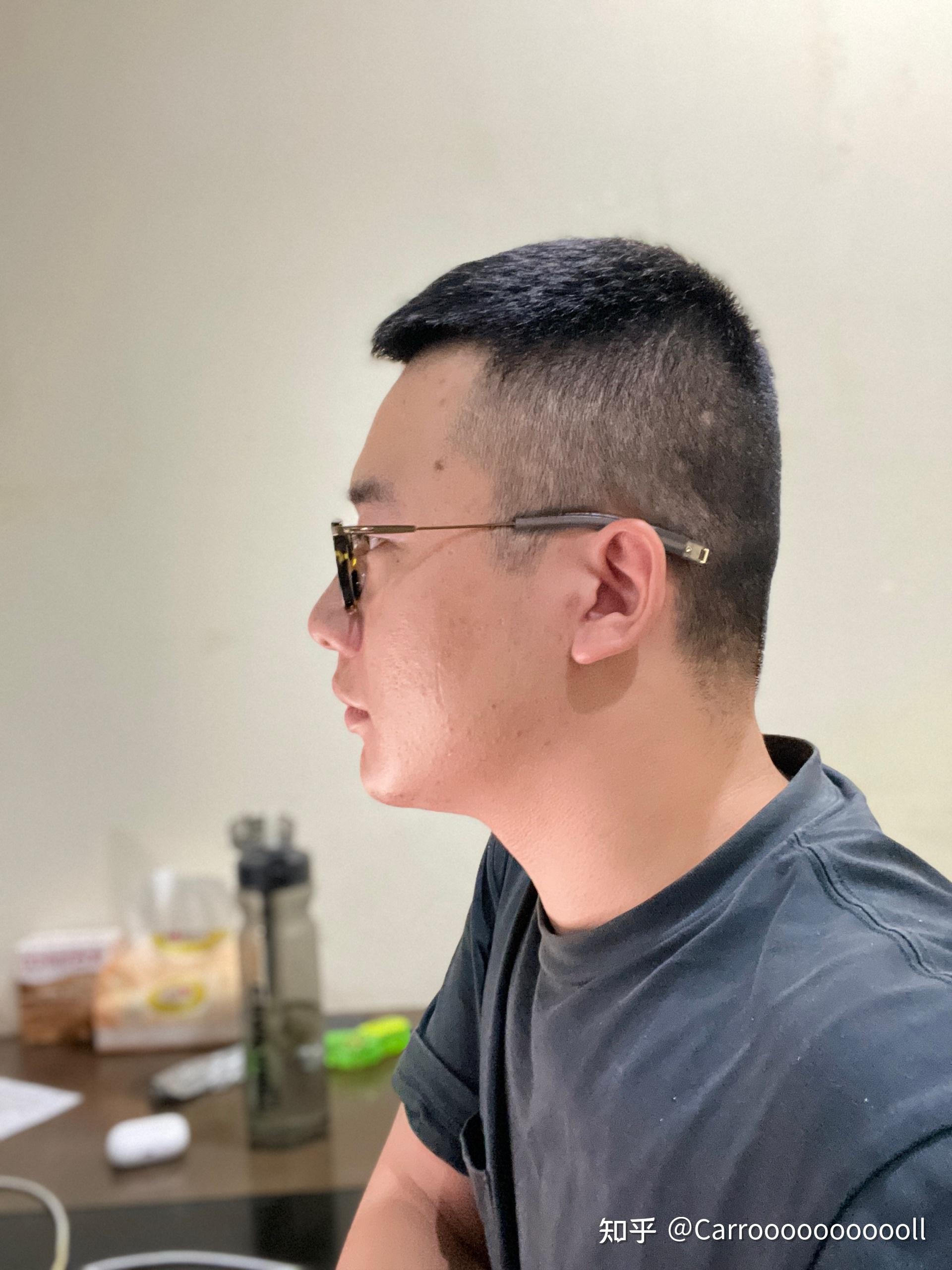 后脑勺平改如何收拾头发?