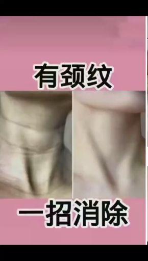 咋样减少颈纹 v2-672c885ac0cb1c62407d0890384529be.jpeg