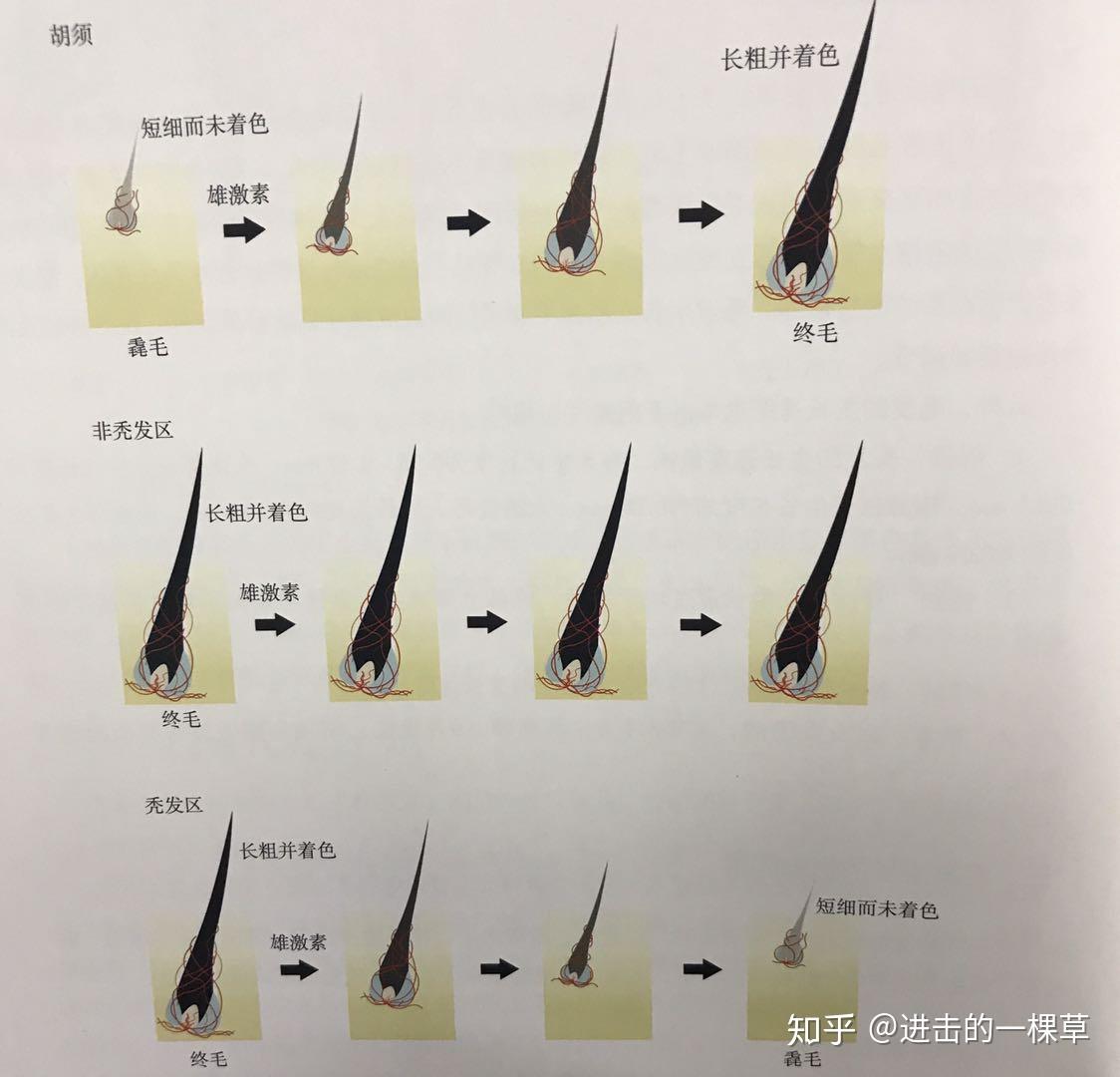 阴毛有什么作用？到底能不能刮？提醒：2种情况刮掉会更健康