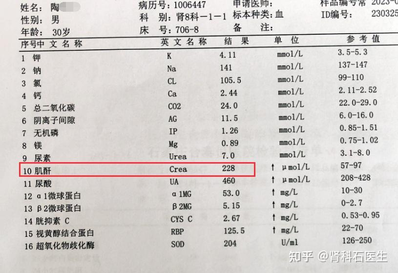 肌酐怎么读图片