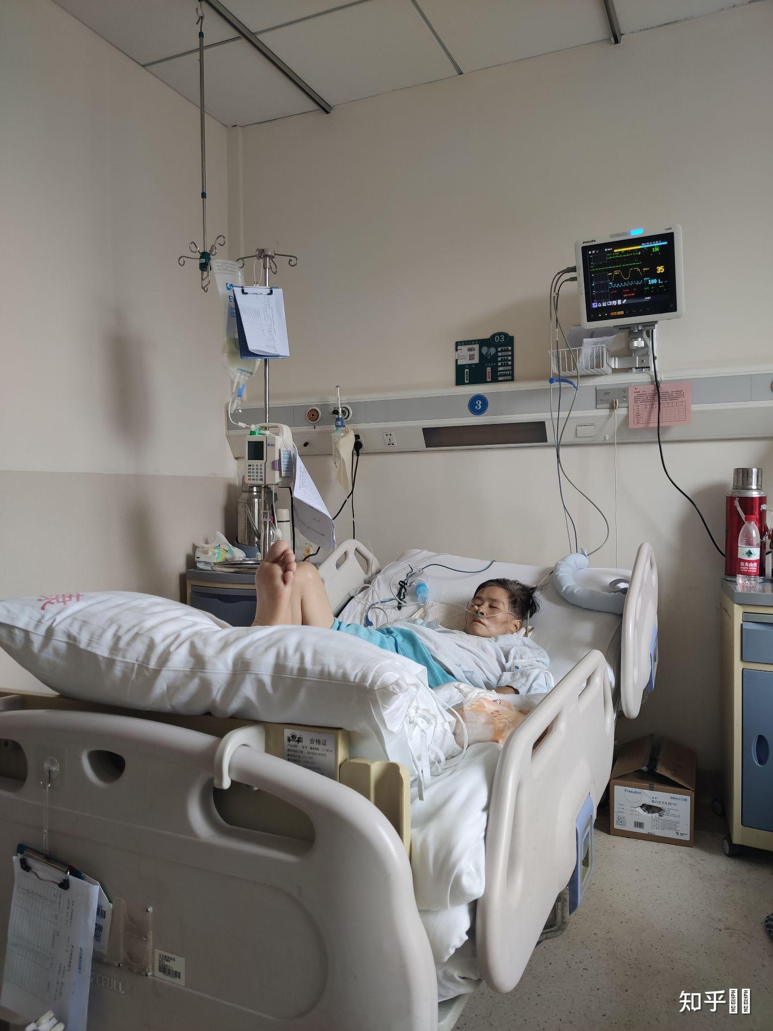 你知道的胰腺癌患者都活了多久? - 知乎