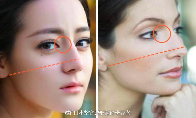 娱乐圈年年贡献大美人你却偏偏喜欢迪丽热巴日本整容整形