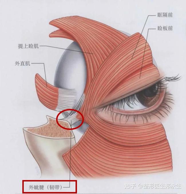 睑外翻有什么治疗方案? - 知乎