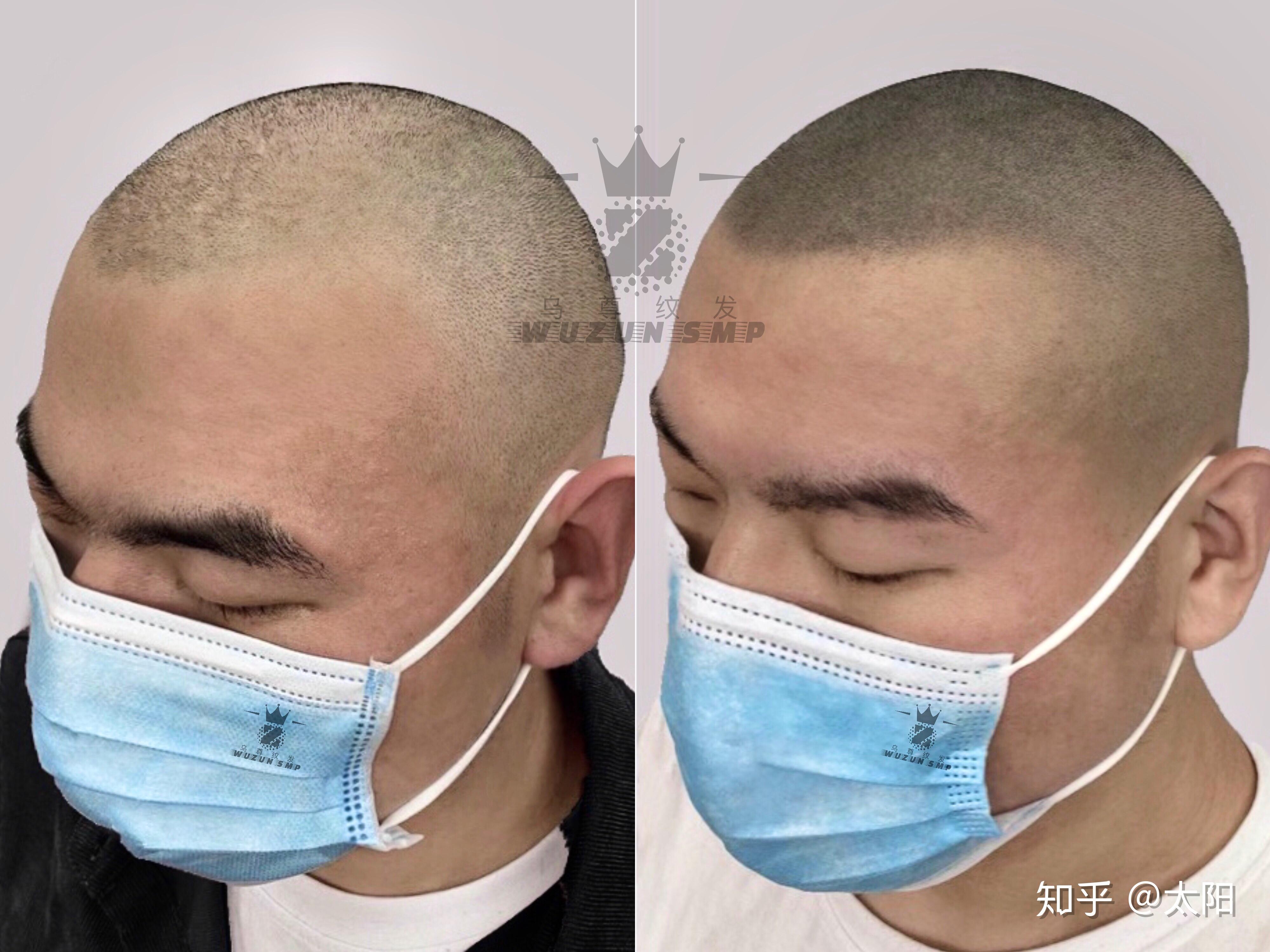 纹发，既然不是真头发，为什么还要纹发？乌尊纹发老师的看法 - 知乎