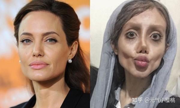六例全球整容案例巴西狗头人的奇葩改造手术