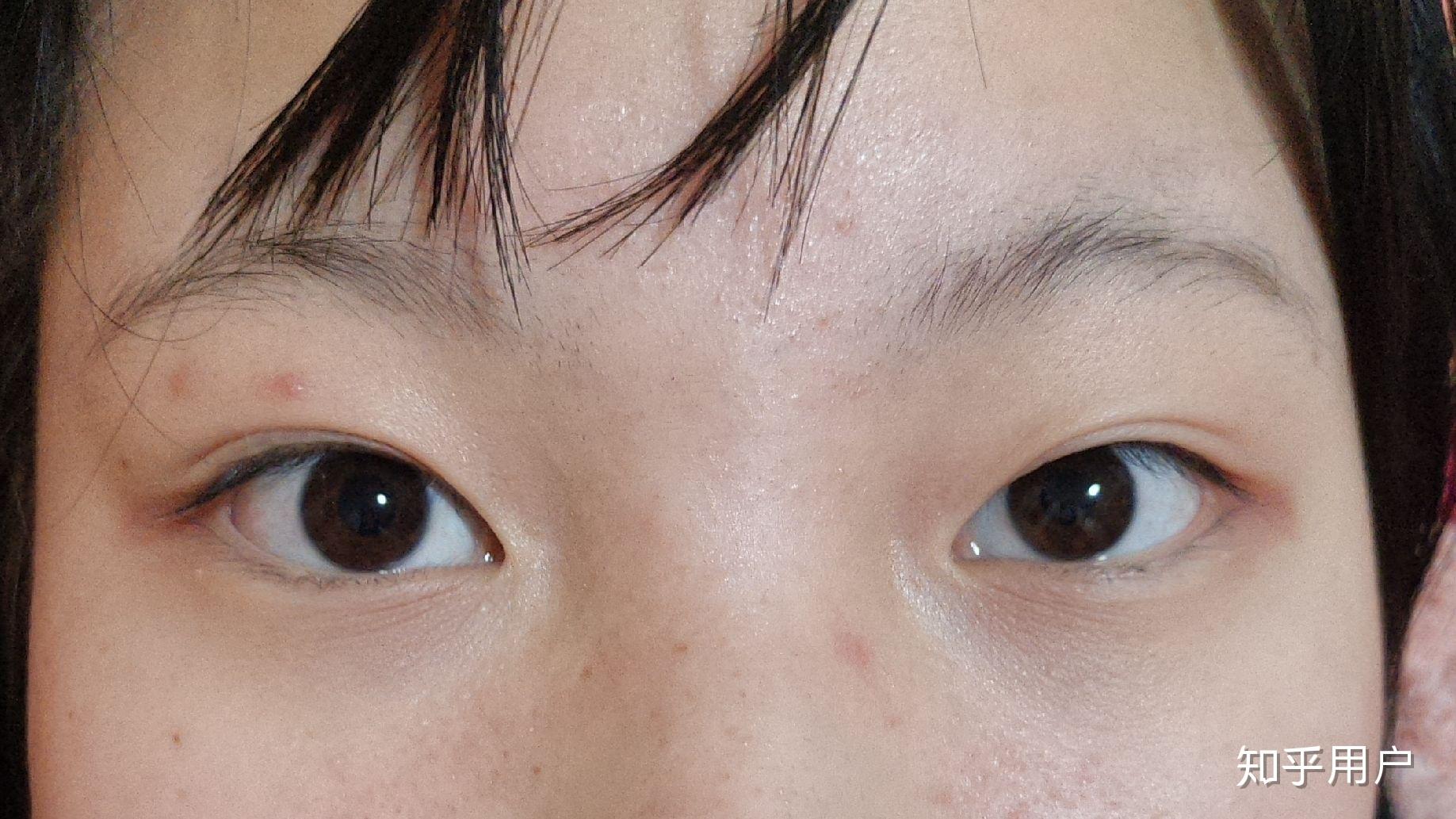 眼距宽是种什么体验