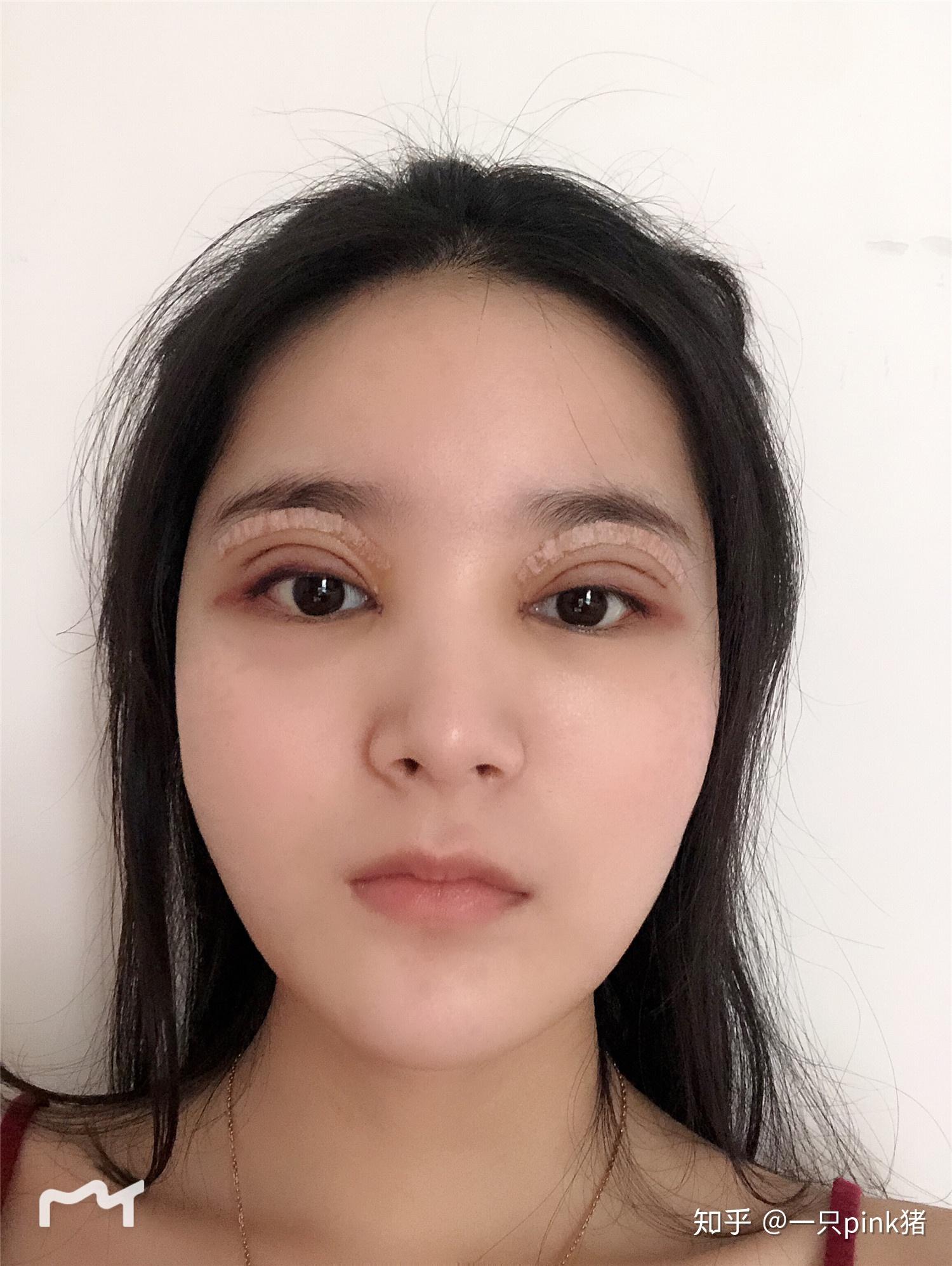 欧美大双眼皮到底好不好看,我这算是失败了吗? - 知乎