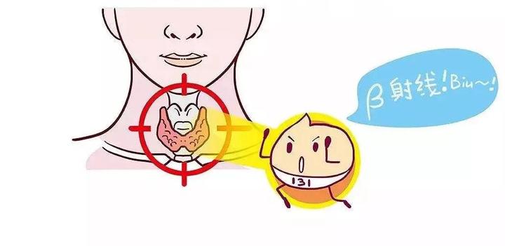 用碘131治疗甲亢需要注意些什么