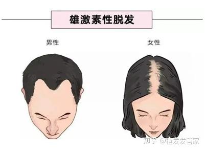发缝越来越宽怎么办?解决发缝变宽的正确姿势