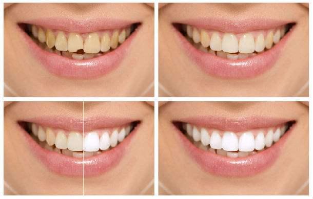 v2-680aab900e5a29ab19cb4e2862faf372_1440w.jpg?source=172ae18b