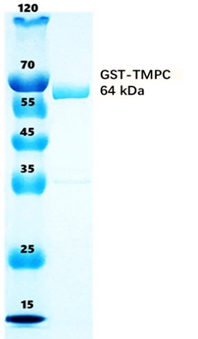 Tmpc Process Graph TMPC 重组蛋白 - 知乎
