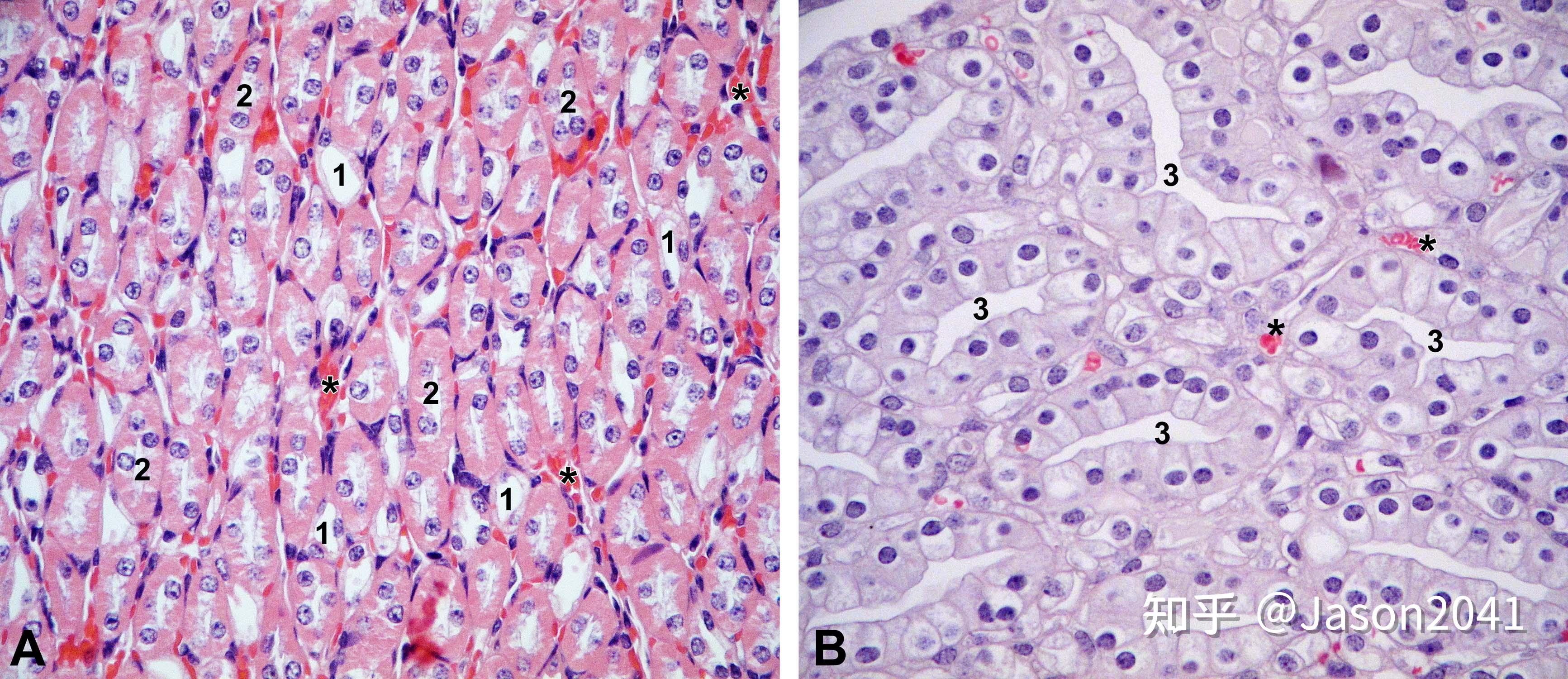 肾切片显微镜下结构描述？ - 知乎