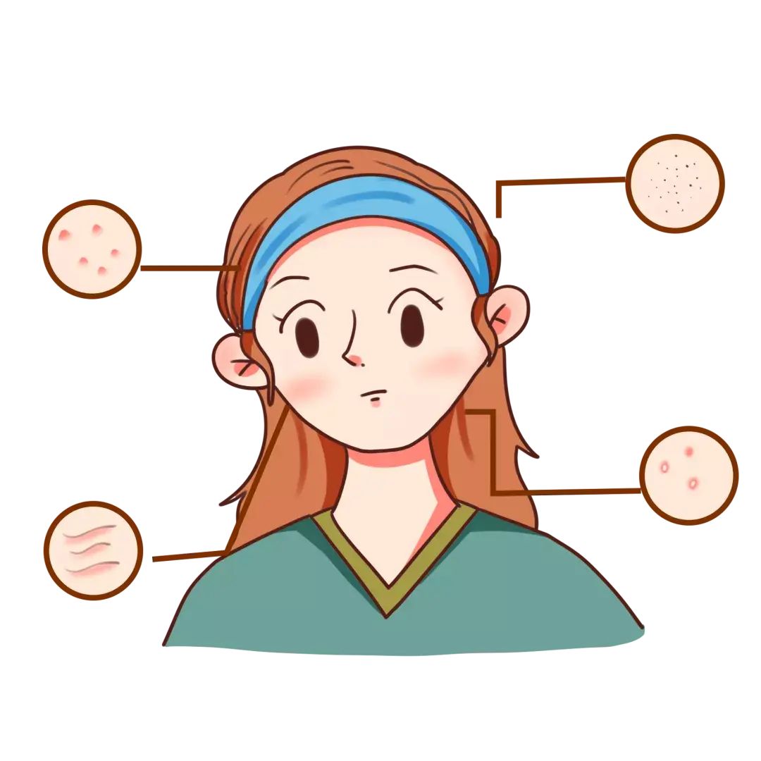 美莱日常应该如何呵护肌肤换季敏感