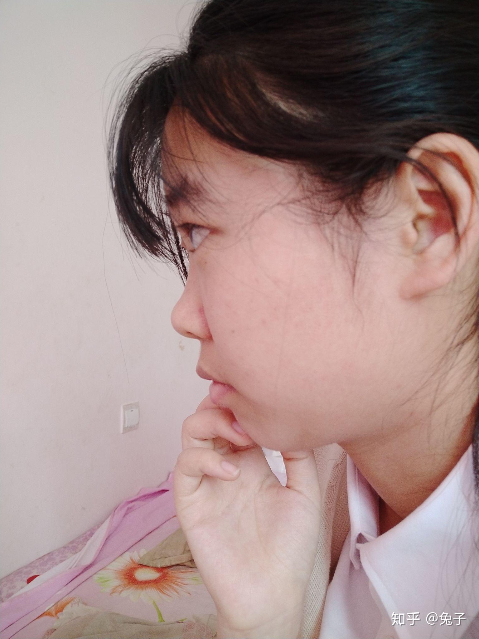 没有鼻梁鼻子塌的人是什么体验