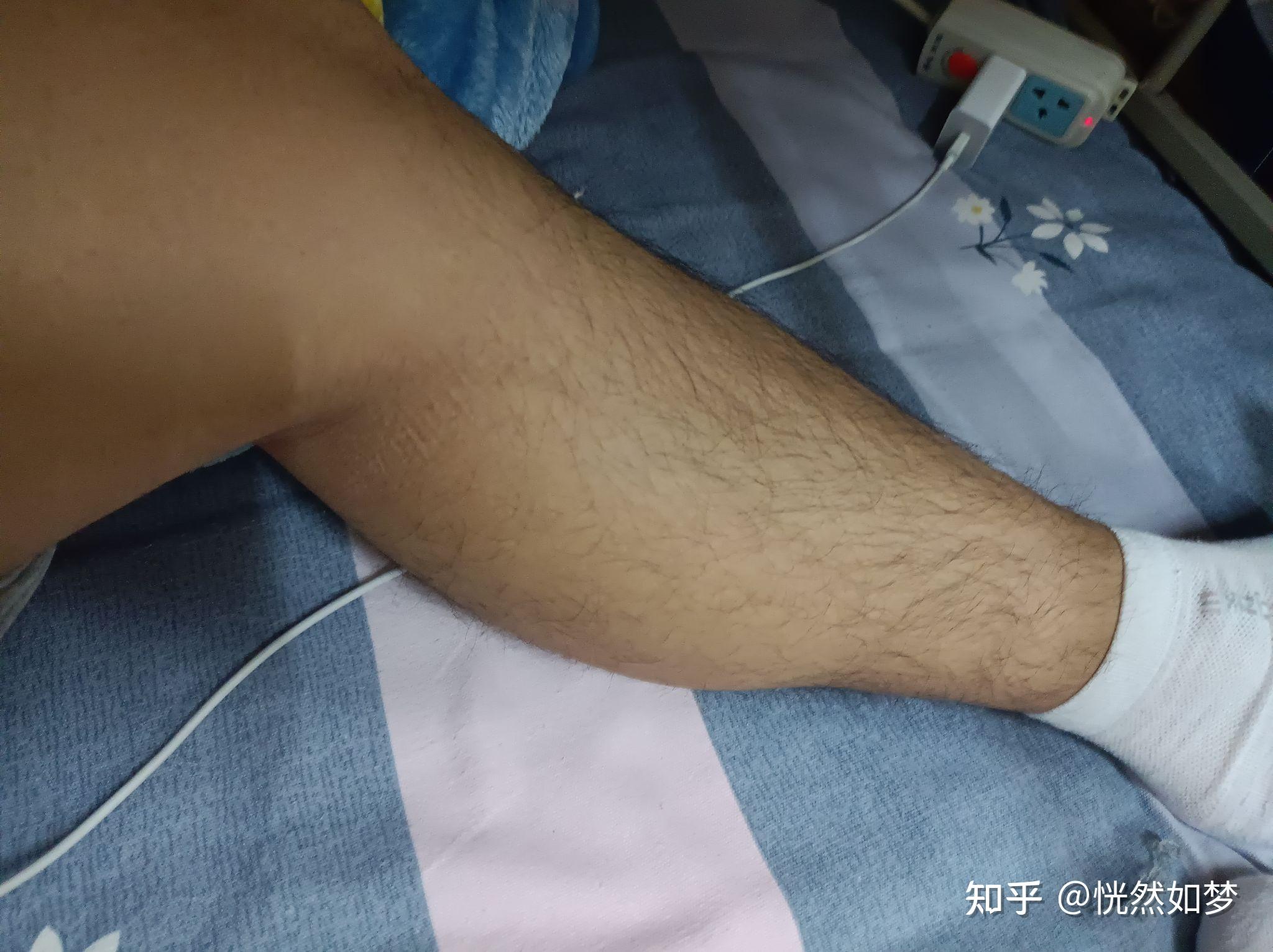 男生有什么好的方法瘦小腿? - 知乎