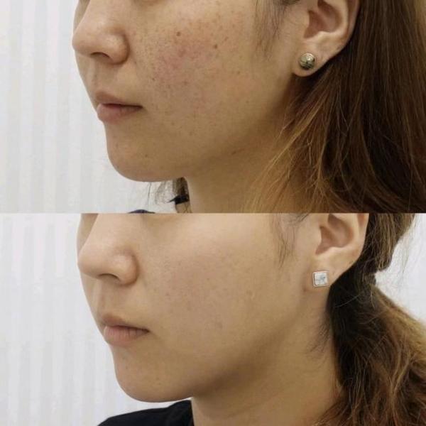 二,真人案例 价格对比