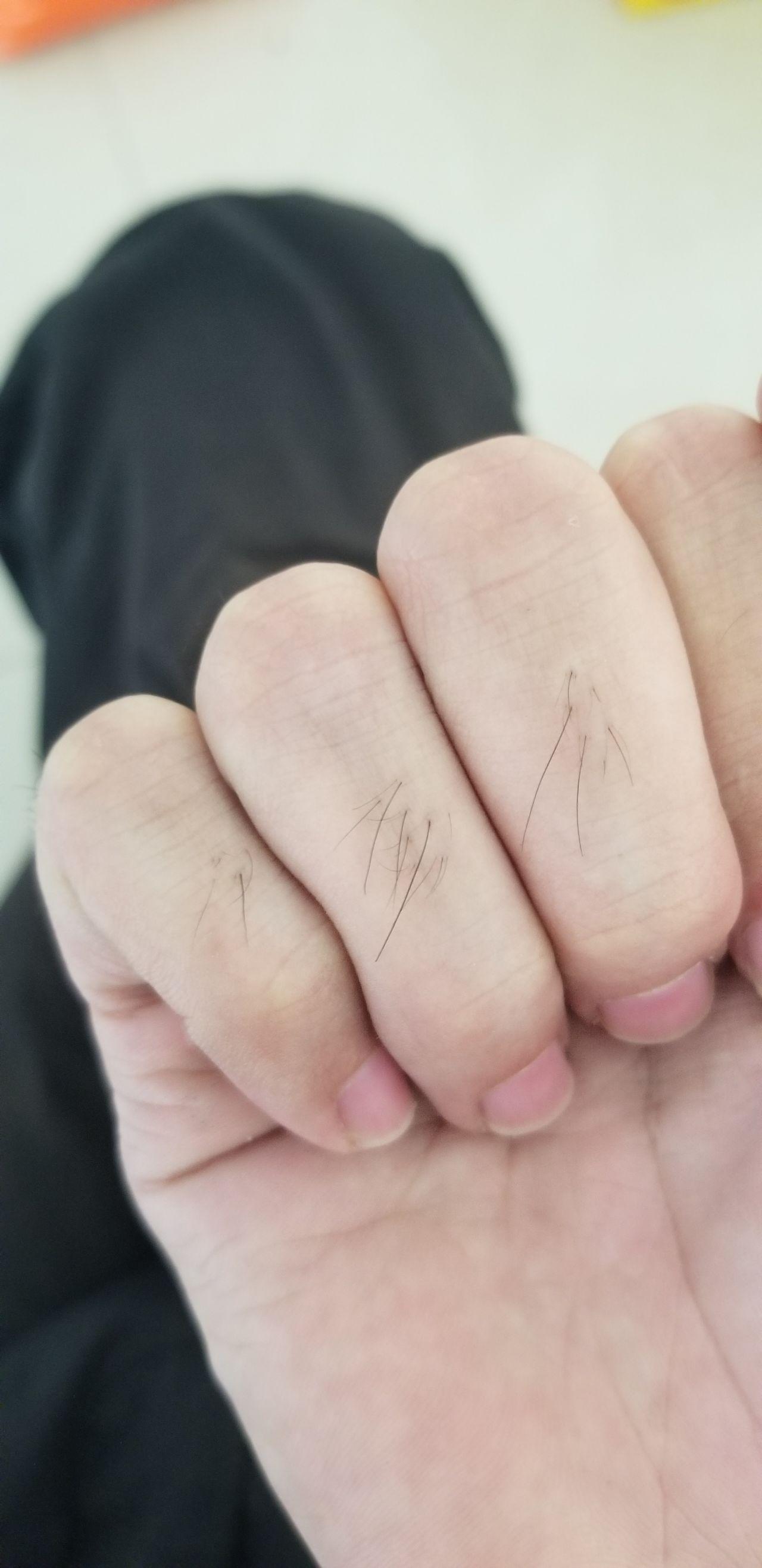 手指上长毛是一种什么样的体验? - 知乎