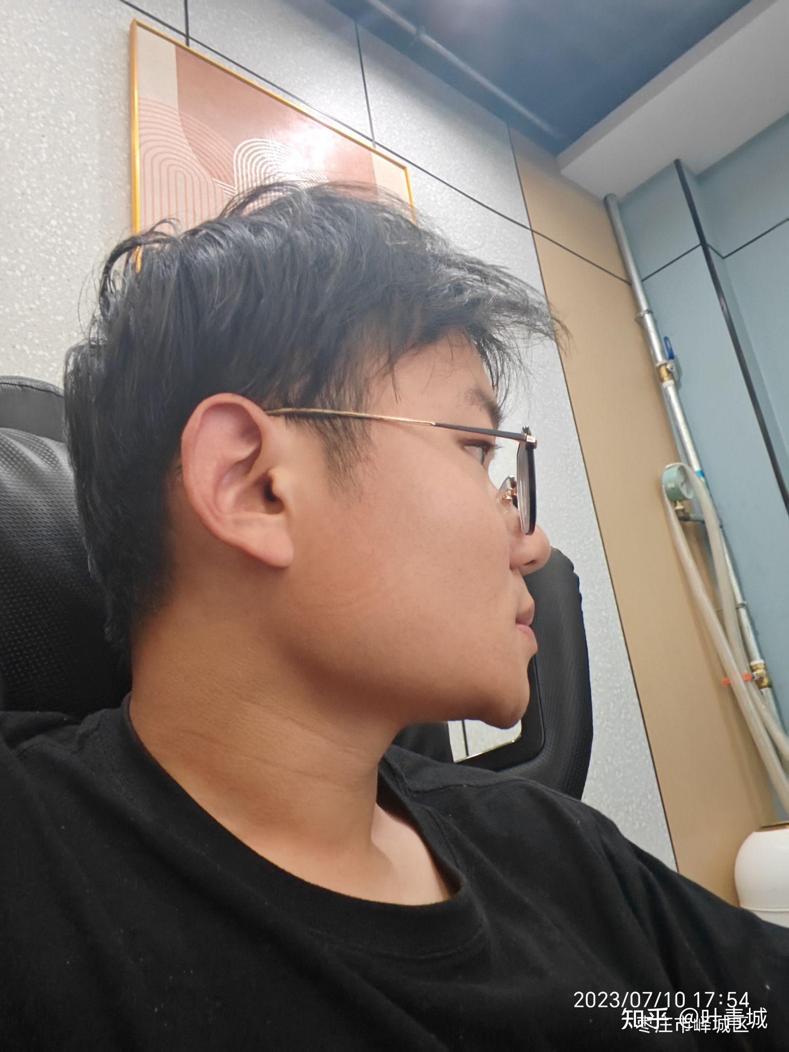 正脸正常侧脸丑到爆是什么体验