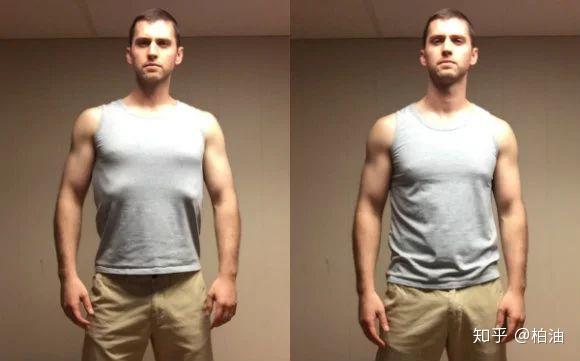 如何真正有效地纠正肋骨外翻