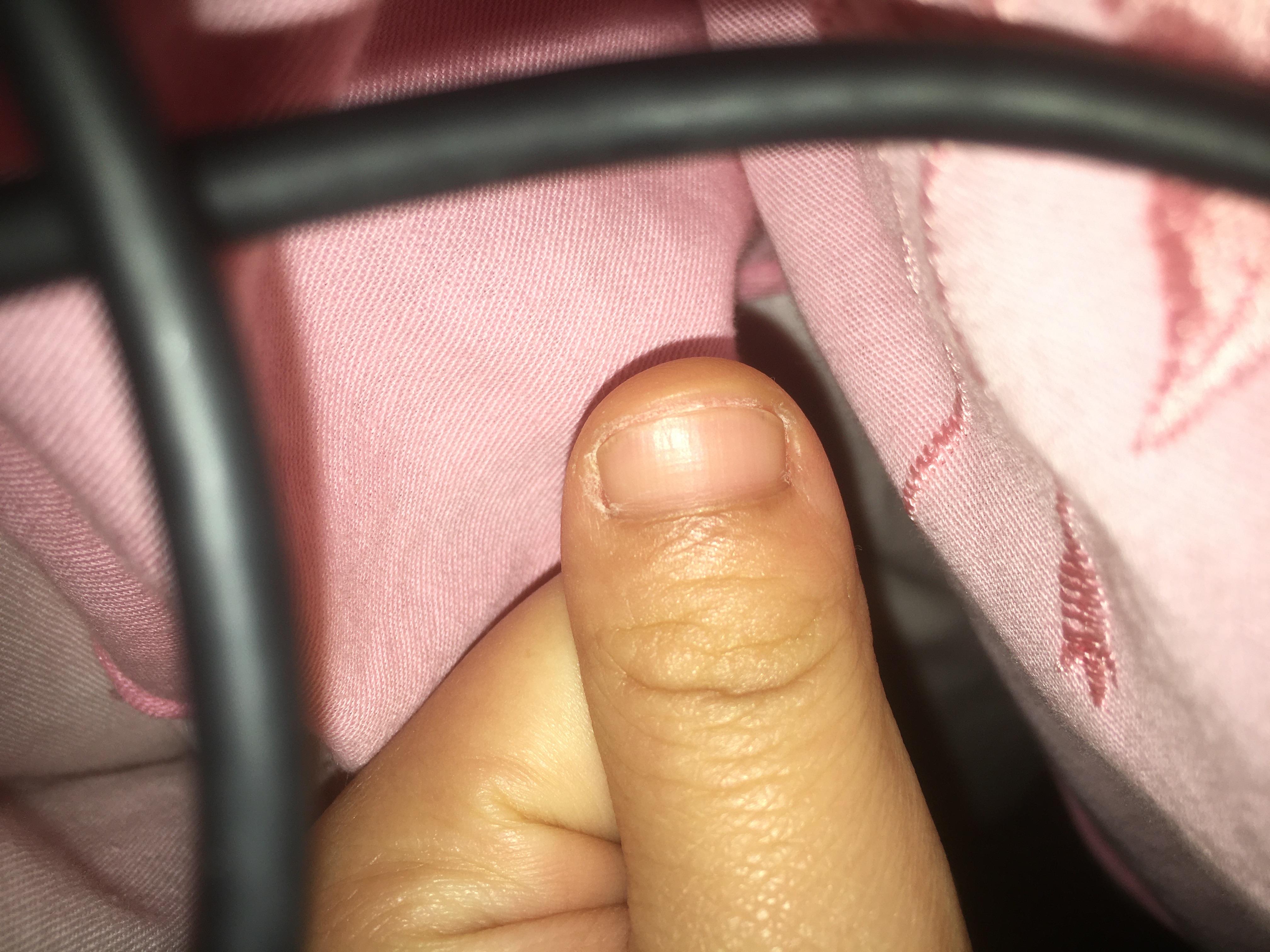 为什么我的大拇指又宽又短? - 知乎