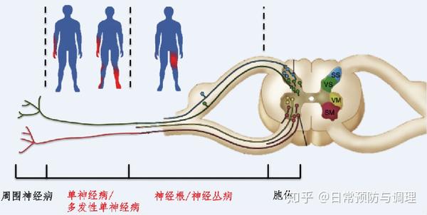 掌握这些知识点,诊断不典型周围神经病不再难 - 知乎