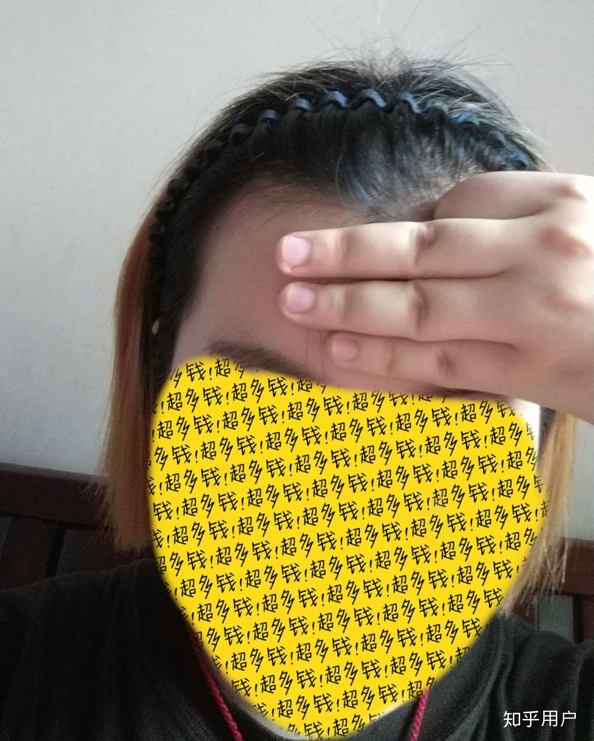 发际线太低是怎样的体验